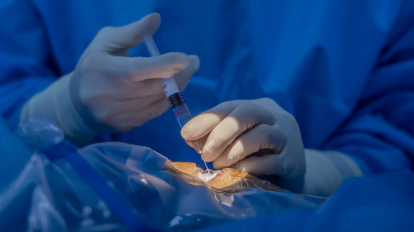 Revolucionarna injekcija gela u oko: Nada za hiljade ljudi FOTO