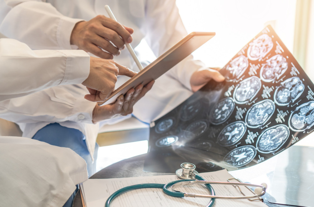 Revolucionarna terapija u lečenju moždanog udara