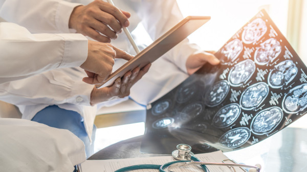 Revolucionarna terapija u lečenju moždanog udara