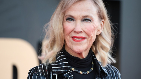 Šta je situs inversus? Retko stanje koje je imala Ketrin O'Hara