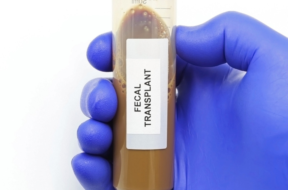 Švedska bolnica traži donore fekalija: Izmet u kapsulama novi način lečenja?