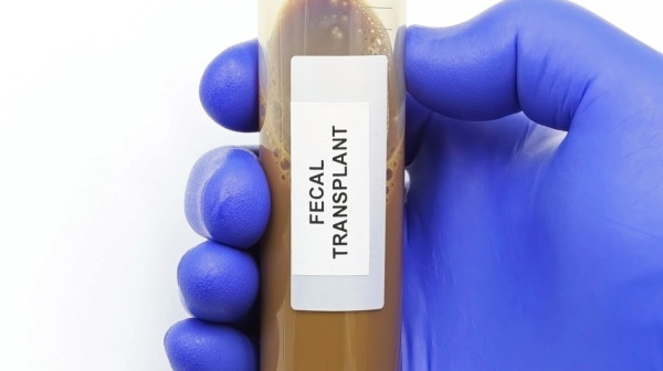 Švedska bolnica traži donore fekalija: Izmet u kapsulama novi način lečenja?