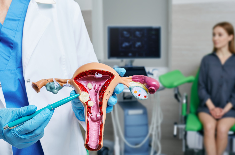 Ciste ili miomi? Ginekolog upozorava kada je vreme da tražite pomoć lekara VIDEO