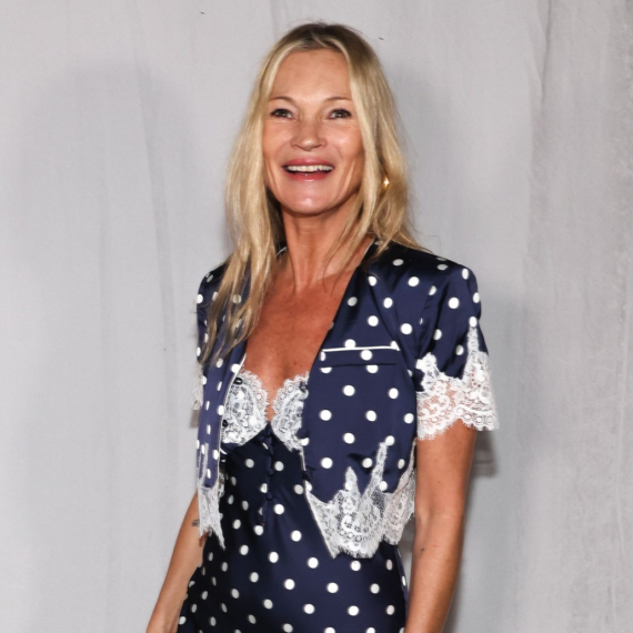 Lepša nego ikad: Seks-bomba devedesetih ima "novo lice" i svima se dopada FOTO