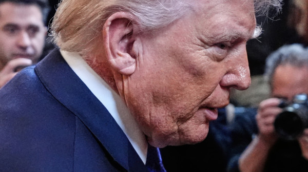 Dermatolozi upozoravaju: Osip Donalda Trampa mogao bi da ukaže na prekancerozno stanje