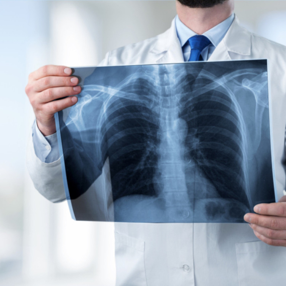 Rutinsko vađenje umnjaka pretvorilo se u noćnu moru: Rendgenski snimak potpuni šok