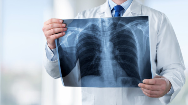 Rutinsko vađenje umnjaka pretvorilo se u noćnu moru: Rendgenski snimak potpuni šok