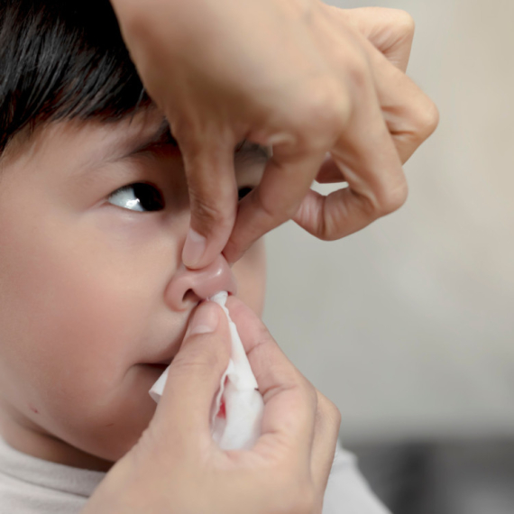 Krvarenje iz nosa kod dece: Kada je vreme za brigu?