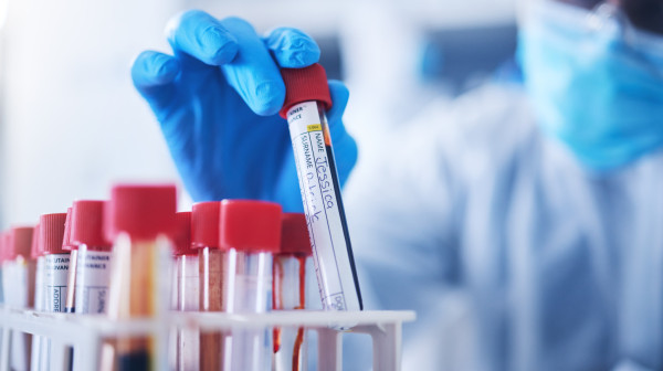 Ovo oboljenje je najčešći uzrok srčanog i moždanog udara