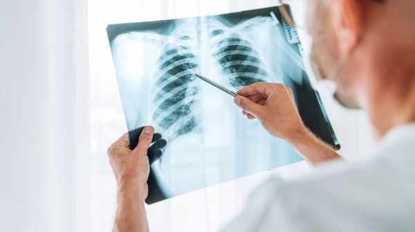 U Srbiji 410 slučajeva tuberkuloze: Deca sve ređe obolevaju, muškarci i stariji najviše pogođeni