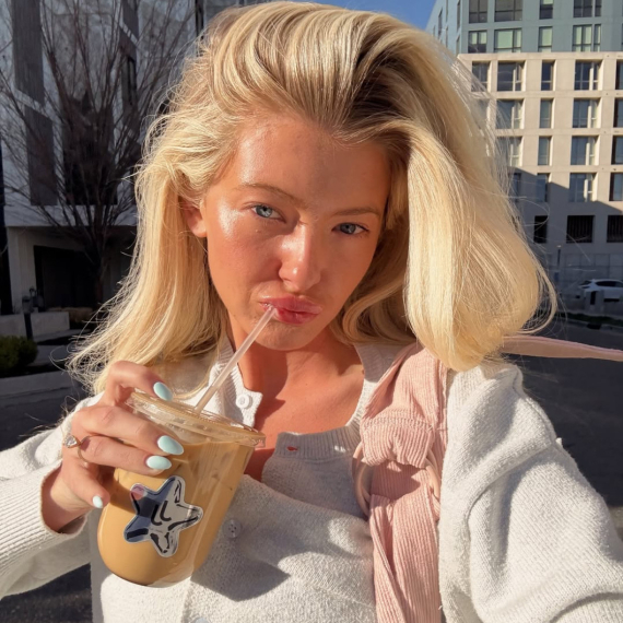 Potrošila je 14.000 evra da bi promenila izgled: Tvrdi da nije nesigurna FOTO