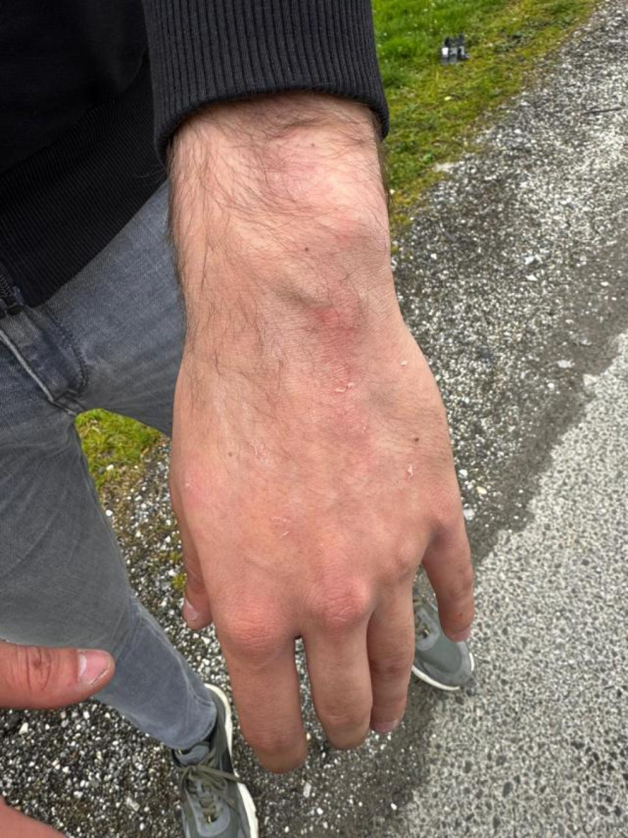 Oglasio se MUP: Privedeno 15 osoba; Sumnja se da su napali aktivistu SNS u selu Ratar – imali hladno oružje