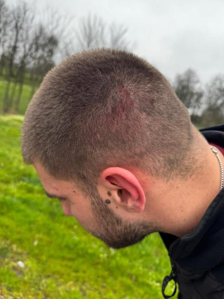 Oglasio se MUP: Privedeno 15 osoba; Sumnja se da su napali aktivistu SNS u selu Ratar – imali hladno oružje