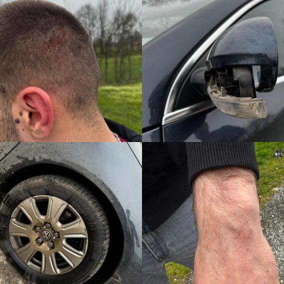 Privedeno 15 osoba; Sumnja se da su napali aktivistu SNS u selu Ratari – u automobilu pronađena 2 metka