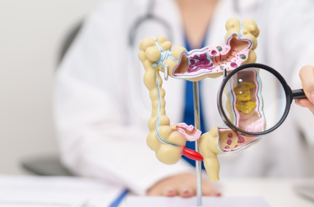 Sve veći porast raka debelog creva kod mladih: "Niko nije premlad za ovu dijagnozu"