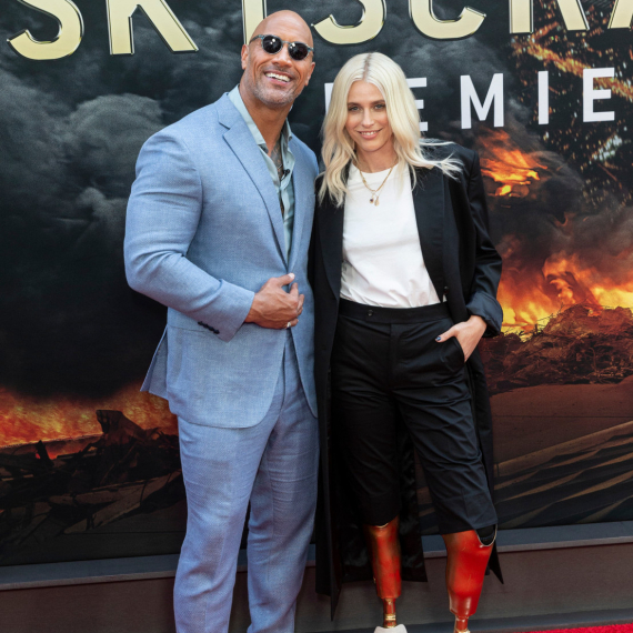 Ovo može da se desi svakoj ženi: Od savršene manekenke do gubitka obe noge FOTO