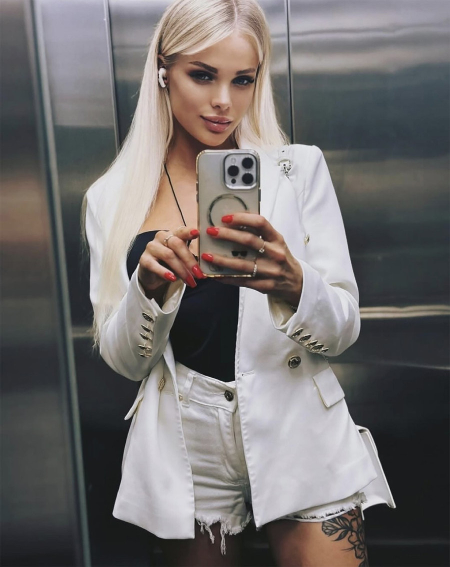 Milioner brutalno pretukao manekenku, pa iznenada umro: Smrskao joj deo lobanje FOTO
