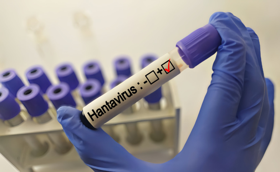 Hantavirus izaziva smrtonosne simptome kod ljudi: Otkazivanje bubrega i unutrašnje krvarenje