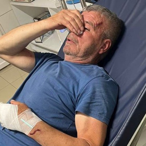 Pretučen Srbin iz Kosovskog Pomoravlja dok jep okušao da zaštiti sina; Hitno se oglasila Kancelarija za KiM