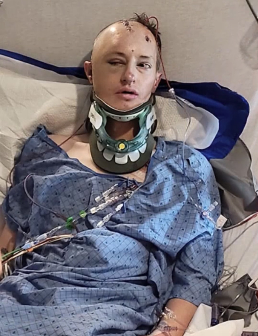 Pao, predozirao se i video onaj svet: Tvrdnje koje lede krv u žilama FOTO