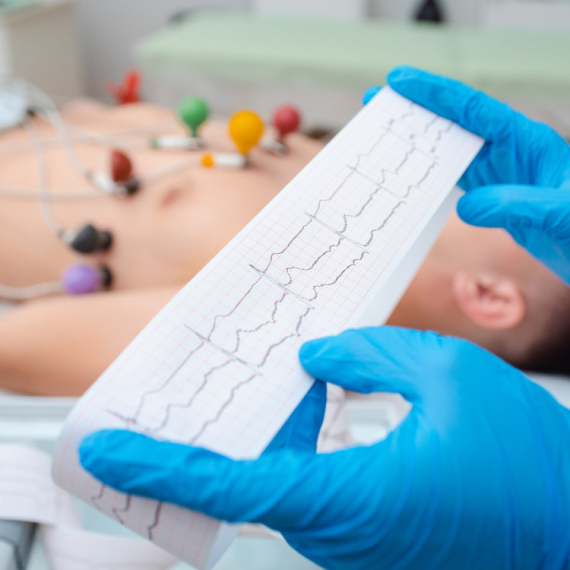 Šta je EKG i kako se pripremiti za pregled?