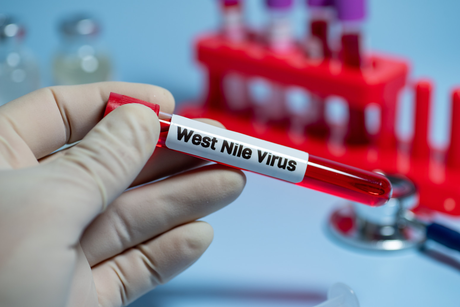 Opasan virus se širi: Sve više umrlih u Grčkoj, prvi smrtni slučaj i u Severnoj Makedoniji