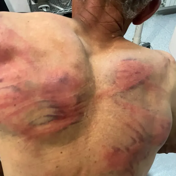 Petković: "Ovo su slike Kurtijeve 'demokratije' prema Srbima – modrice, podlivi i zversko zlostavljanje" FOTO