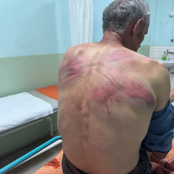 Jezivo nasilje: Tzv. kosovska policija pretukla Srbina; Hitno se oglasila Srpska lista FOTO
