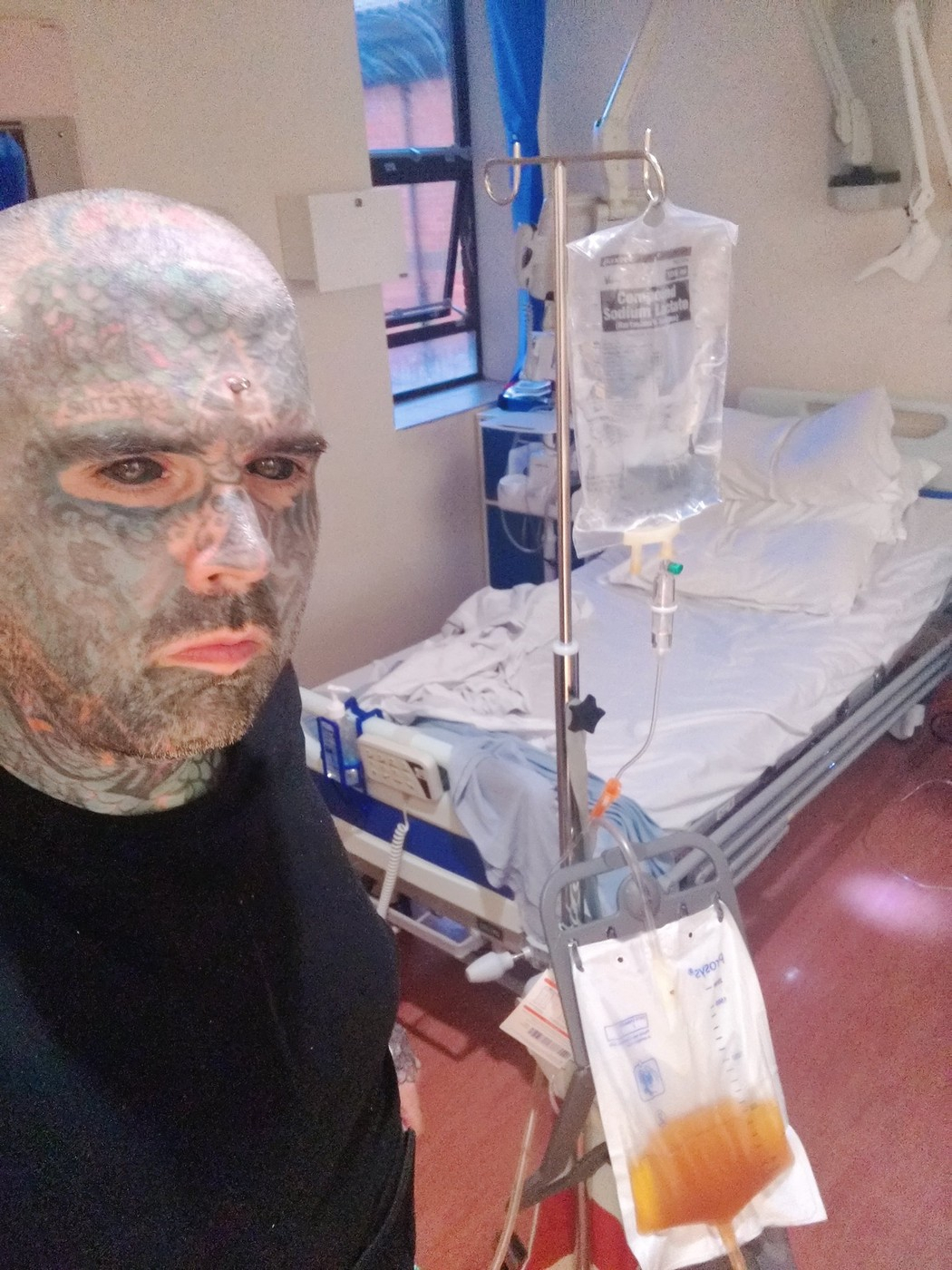Tetovirao i beonjače, pa iznenada oslepeo: Lekari nemaju odgovor FOTO