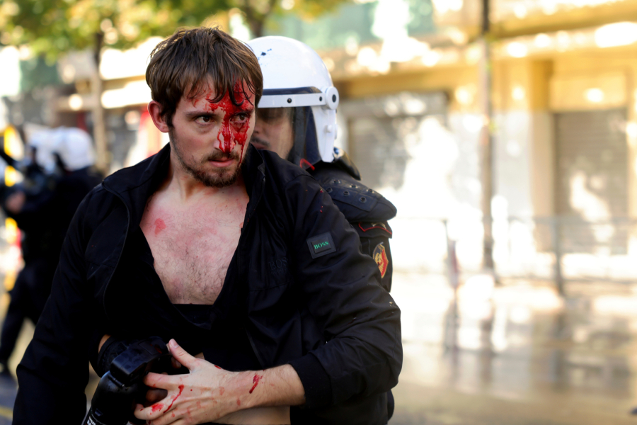 Karambol u Albaniji; Gorelo u Tirani; Letele kamenice i Molotovljevi kokteli FOTO/VIDEO