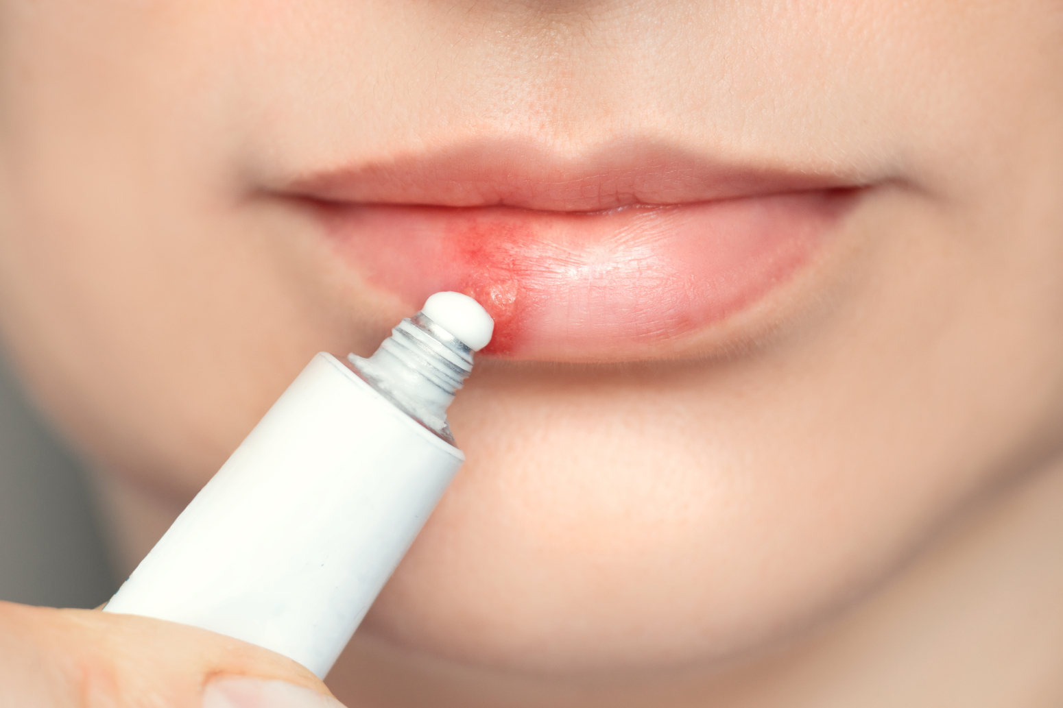 Virus koji milioni imaju: Herpes može da napravi haos u mozgu, čak i najteže bolesti