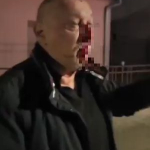 Strašno nasilje u Bačkoj Palanci: Blokaderi pretukli čoveka VIDEO