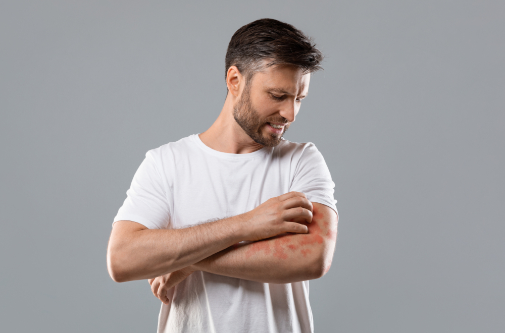 Ako imate problem, javite se dermatologu što pre: Efikasne terapije za psorijazu postoje u Srbiji