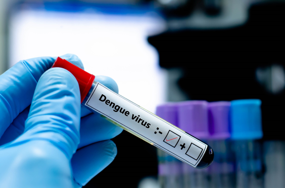 Lekari upozoravaju: Epidemija se ne smiruje, 173 smrtna slučaja u oktobru