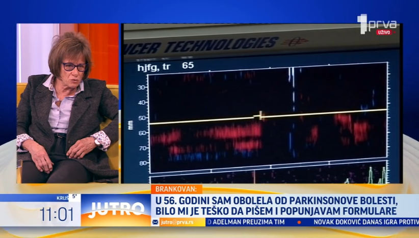 Koji su prvi simptomi Parkinsonove bolesti?