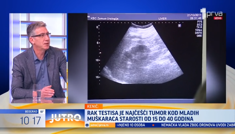 Mladi košarkaš od 20 godina oboleo od raka testisa