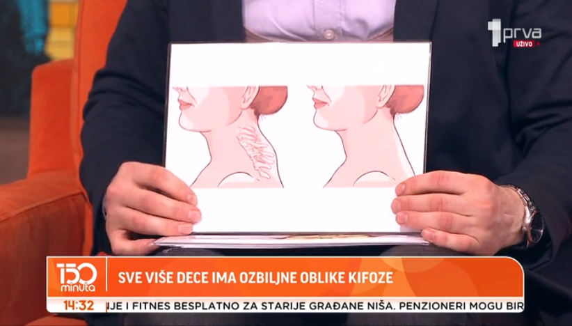 Tehnološki vrat - zašto se pojavljuje grba?