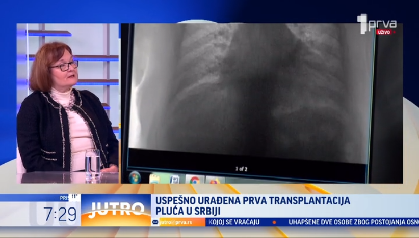Prva transplatacija pluća obavljena je u Srbiji