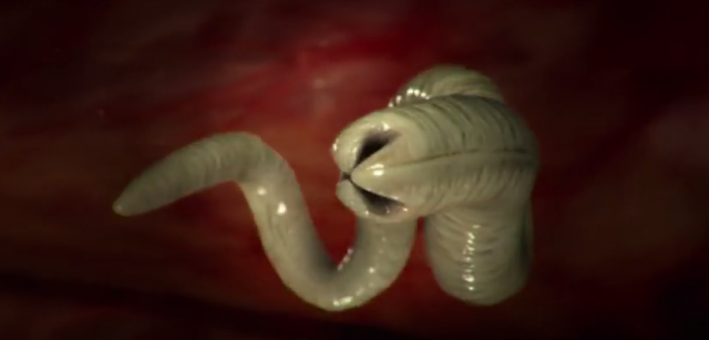 Èoveku iz stomaka izvadili pantljièaru dugu šest metara