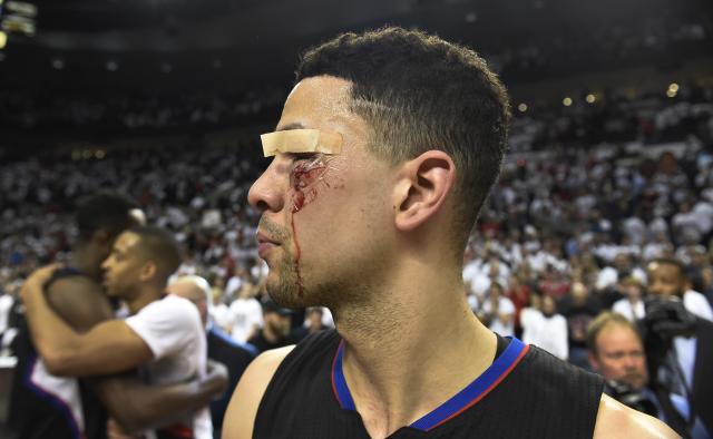 Heroj – podliv, 11 kopèi i povratak na teren