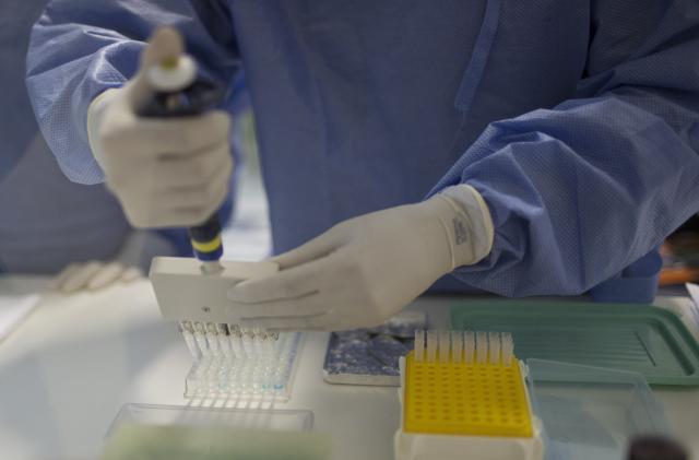 Španija: Prvi sluèaj fetusa zaraženog virusom zika