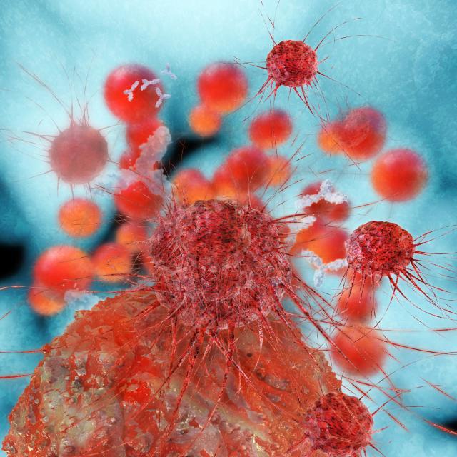 Nauènici tvrde da više neæemo umirati od raka: Ovaj lek imamo svi u kuæi, a spas je od ove opake bolesti