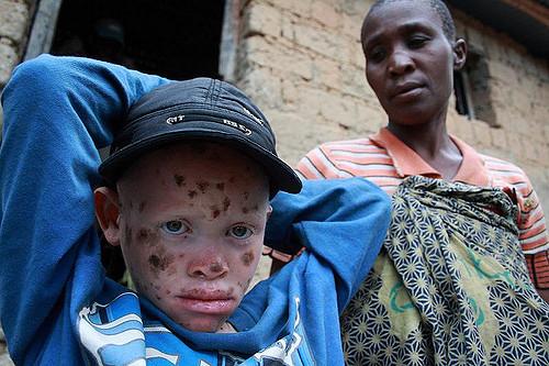 Stravièan lov na „bele crnce“ u Africi