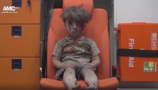 Dečje lice u krvi i prašini – slika i prilika Sirije VIDEO