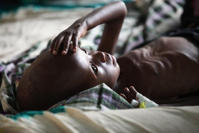 U Africi 16 miliona ljudi u opasnosti od umiranja od gladi