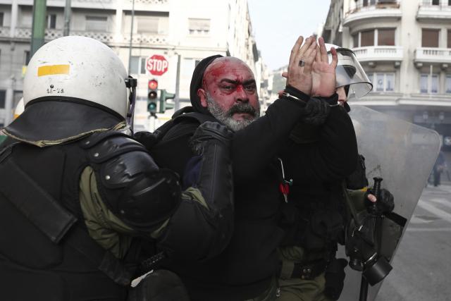 Sukobi u "okupiranoj" Atini: Krvave glave i baklje FOTO