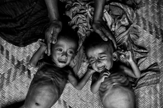UN: Broj gladnih kojima je ugrožen život 124 miliona
