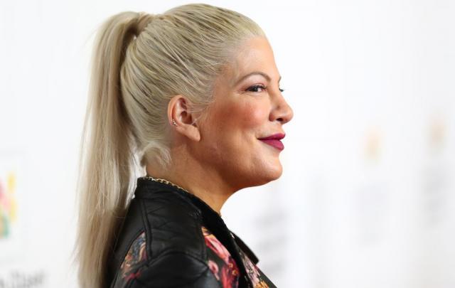 Glumicu niko ne prepoznaje: Nervni slom ostavio vidljive posledice na njenom licu