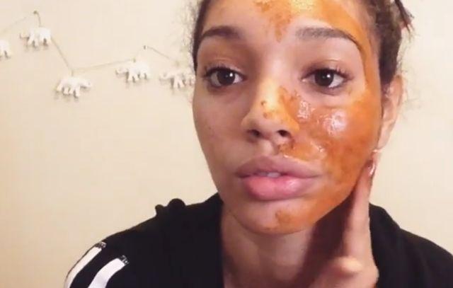 Za 30 dana očistila je svoje lice od akni i ožiljaka: Sada je otkrila kompletnu proceduru