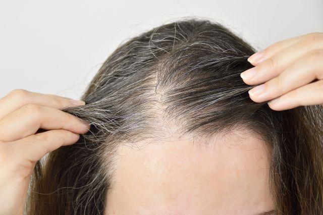 Struènjaci otkrivaju kako da spreèite da vam kosa prerano osedi